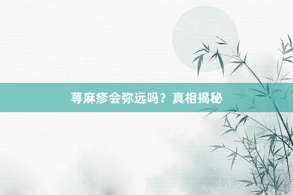 荨麻疹会弥远吗？真相揭秘